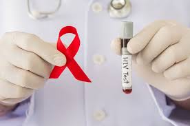 ВИЧ-инфекция: знать и не бояться